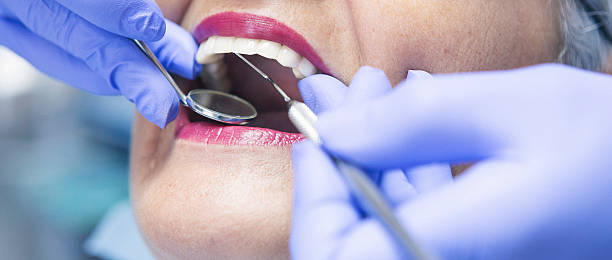 Best Lost Filling or Crown Replacement in Jamul, CA